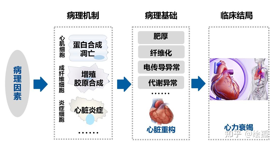 5-heart-failure-hf