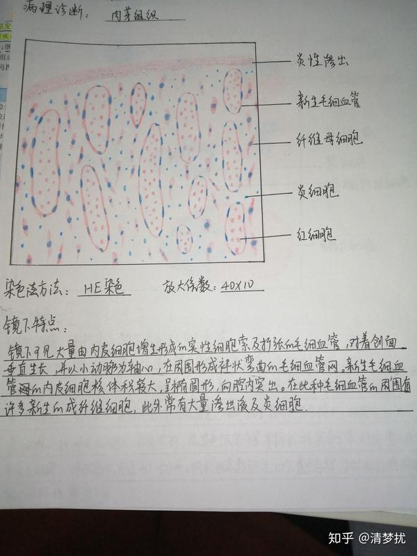 炎细胞红蓝铅笔手绘图图片