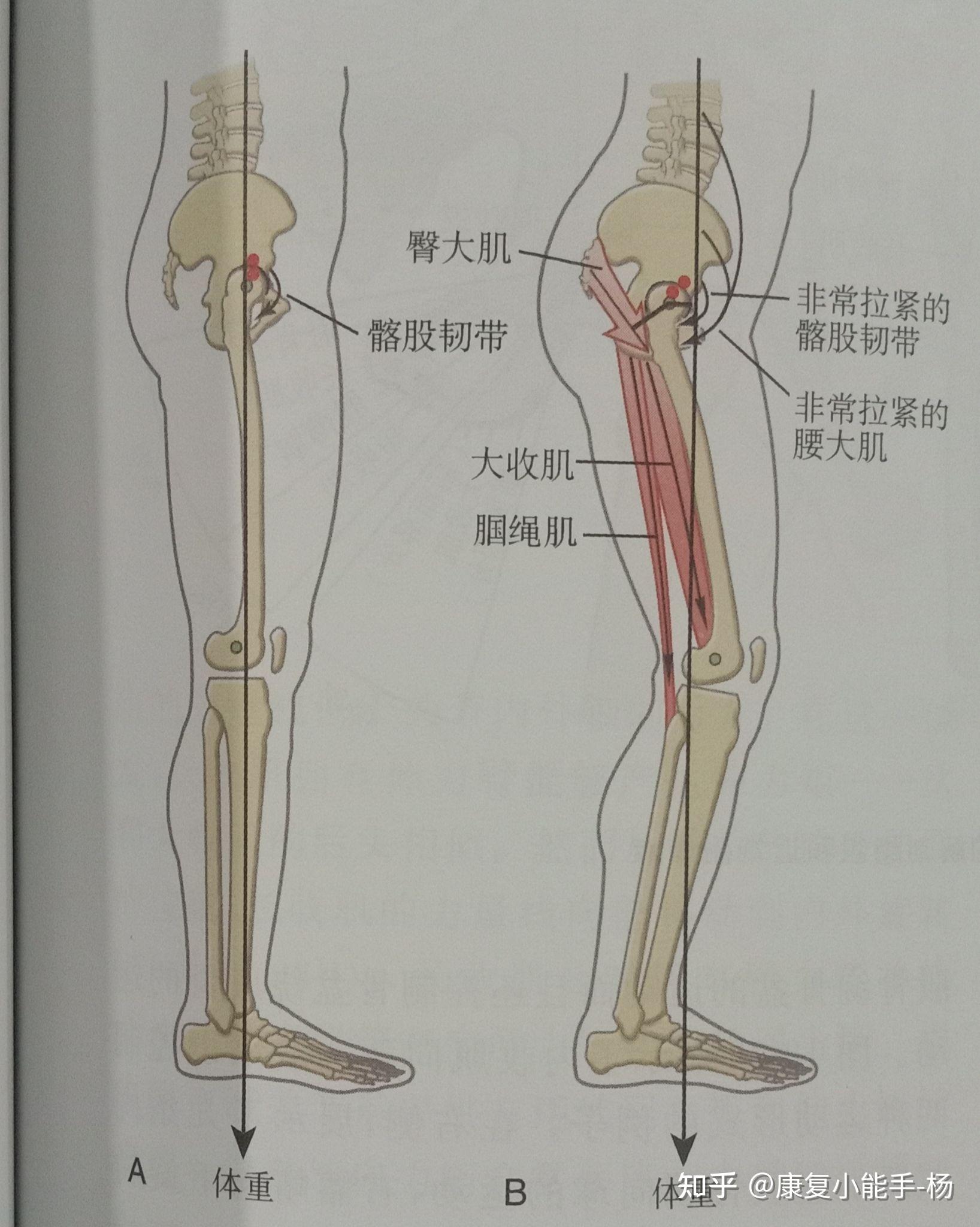 髋关节屈曲90度图片图片