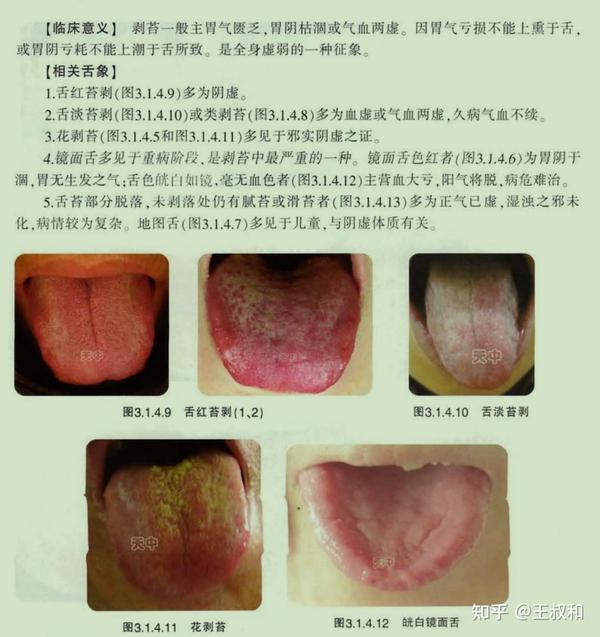 王叔和一文教会你中医舌诊基础知识 - 知乎