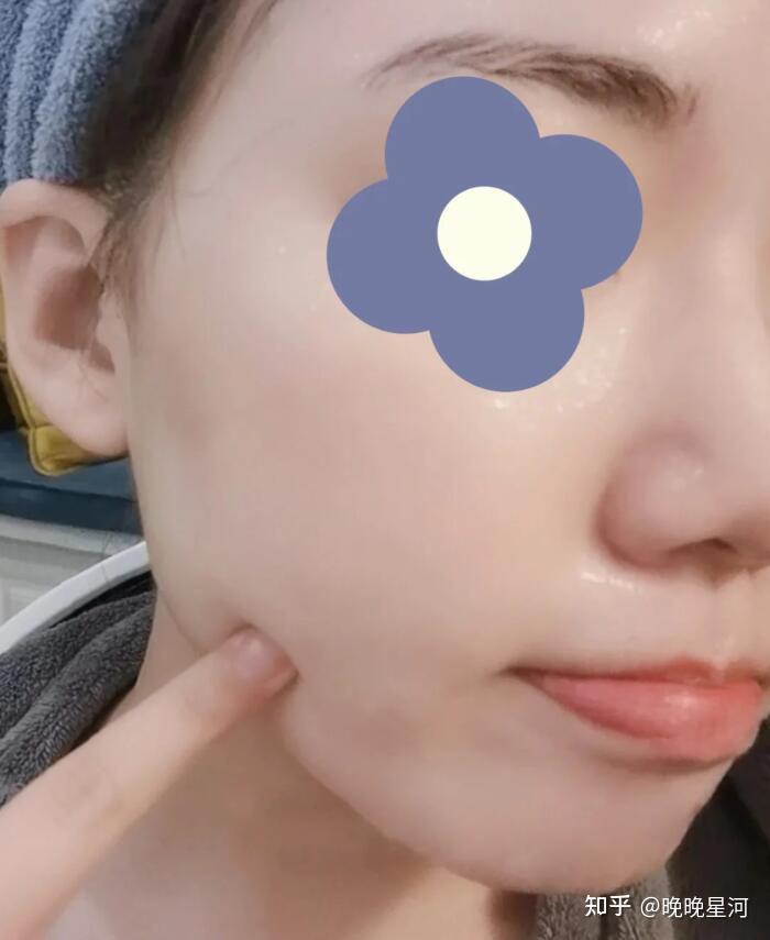 怎样能让皮肤变白 v2-1cefc2bcdf4921297d207b321b4f77f6_r.jpg