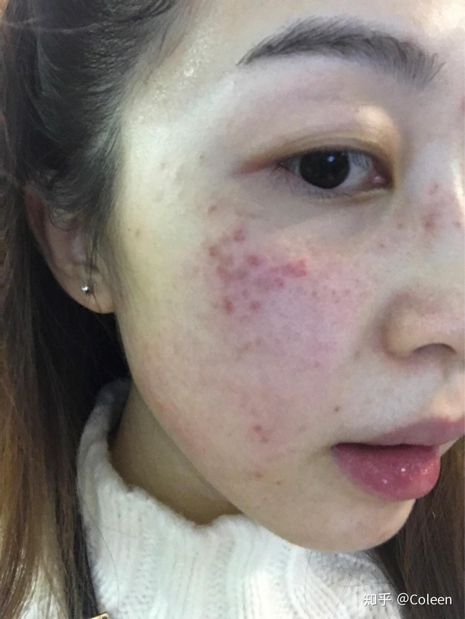 时间太赶没点痣…哎………我是分割线………我来更新咯～～现在是1月