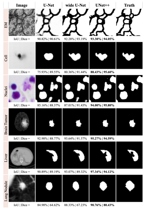 segmentation【医学影像分割】unet  :重新设计跳过连接以利用图像