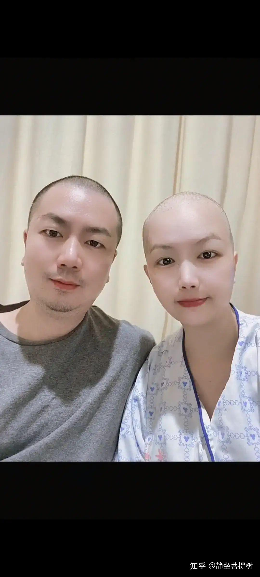 生怕妻子自卑,丈夫自己也一起剃了光头,这样感人的爱情,真让人有些