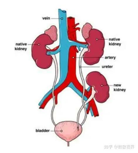 移植肾的位置图片图片