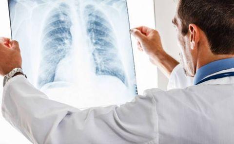 v2-1e62673b1b6dd62e6b7123c9fa539b12_1440w.jpg?source=172ae18b