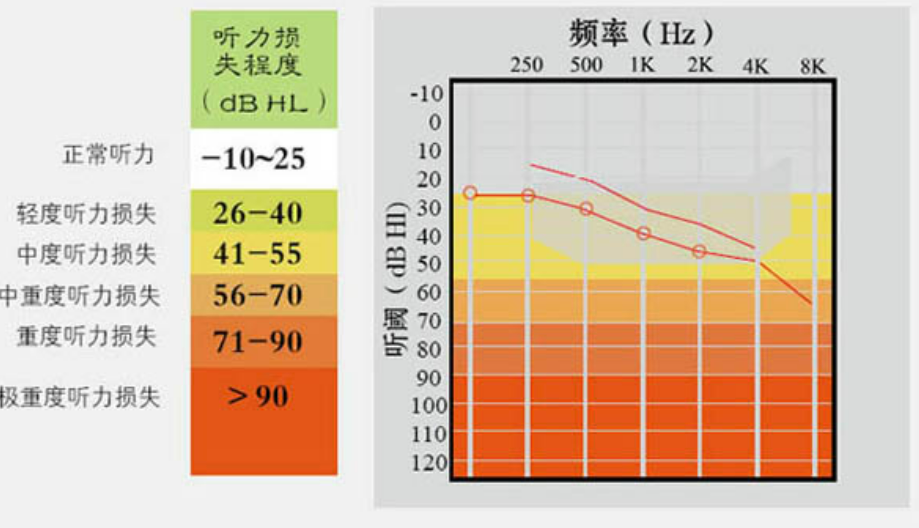 助听器如何挑选？如何判断听力损失的类型？左点助听器——耳背患者的福音分享 - 知乎