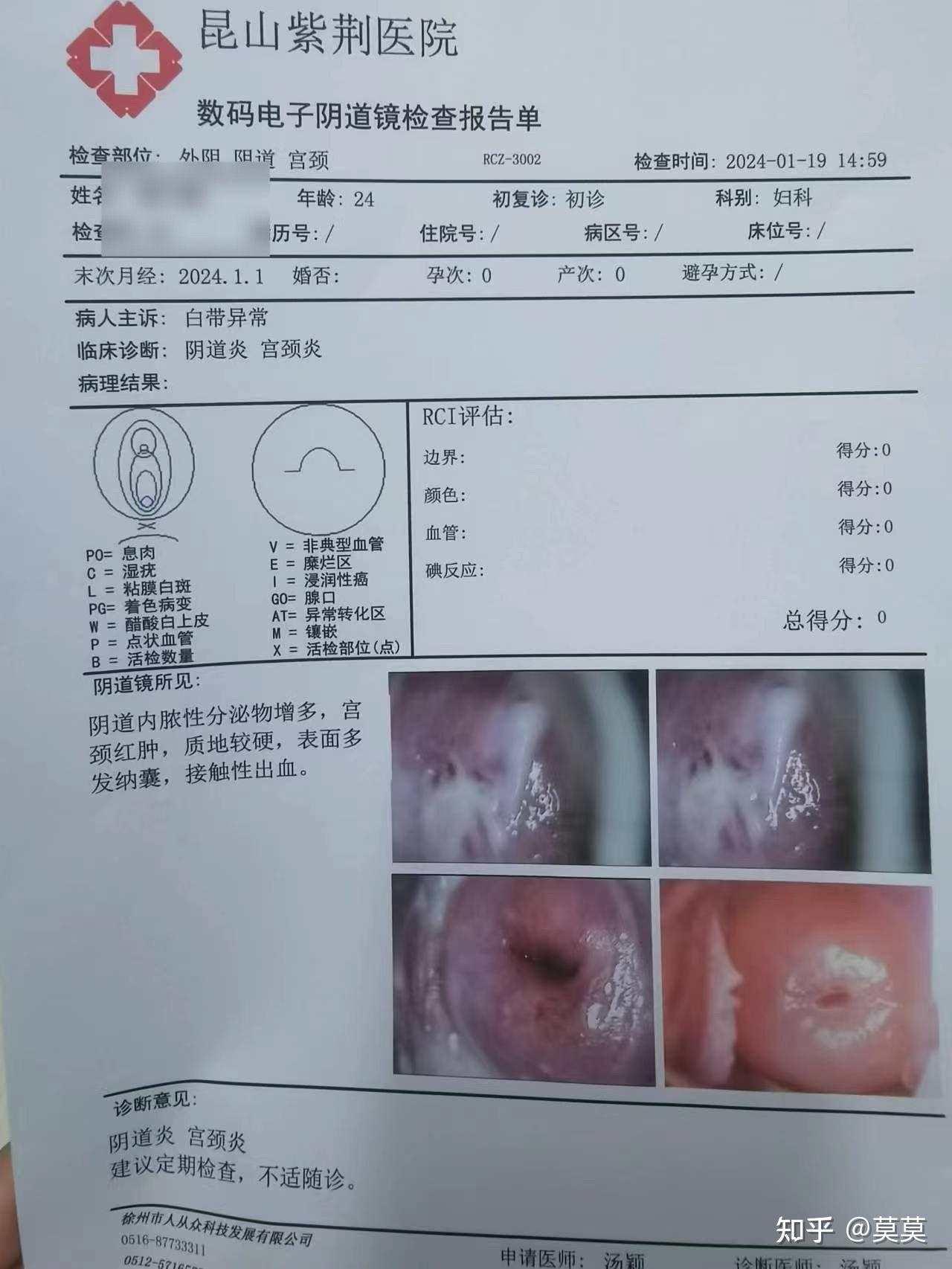 宫颈管炎症状图片图片