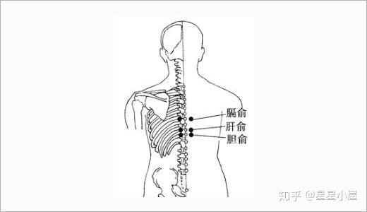 艾灸治疗胆囊息肉