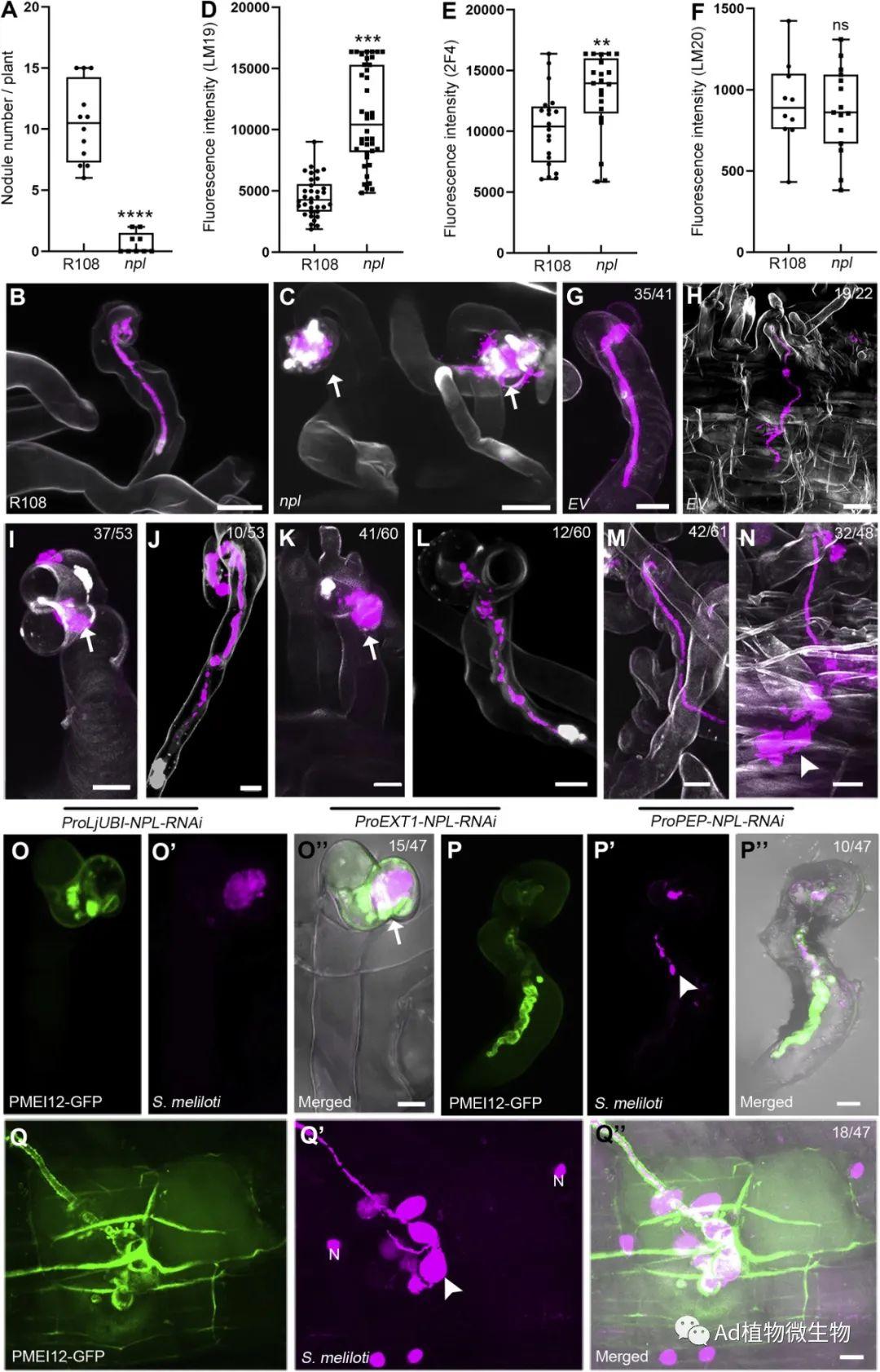 Current Biology | 研究揭示根瘤菌在豆科植物根部跨细胞侵染的机制! - 知乎