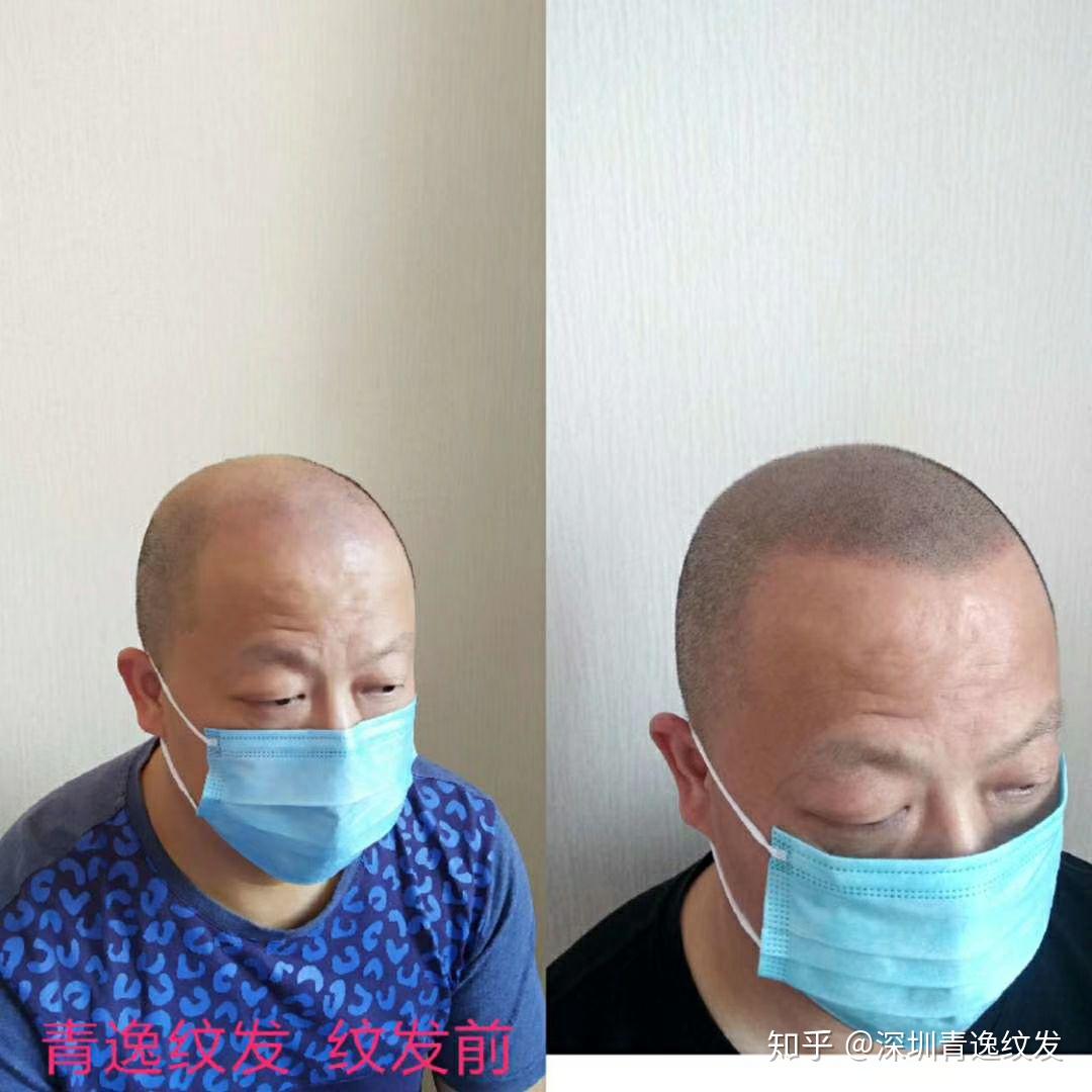 纹发效果 - 知乎