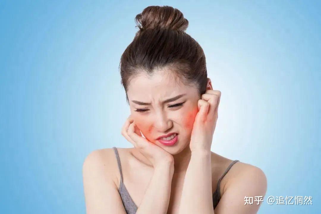 晒伤了怎么办?这份最全的“晒后修复”指南,请收好! - 知乎