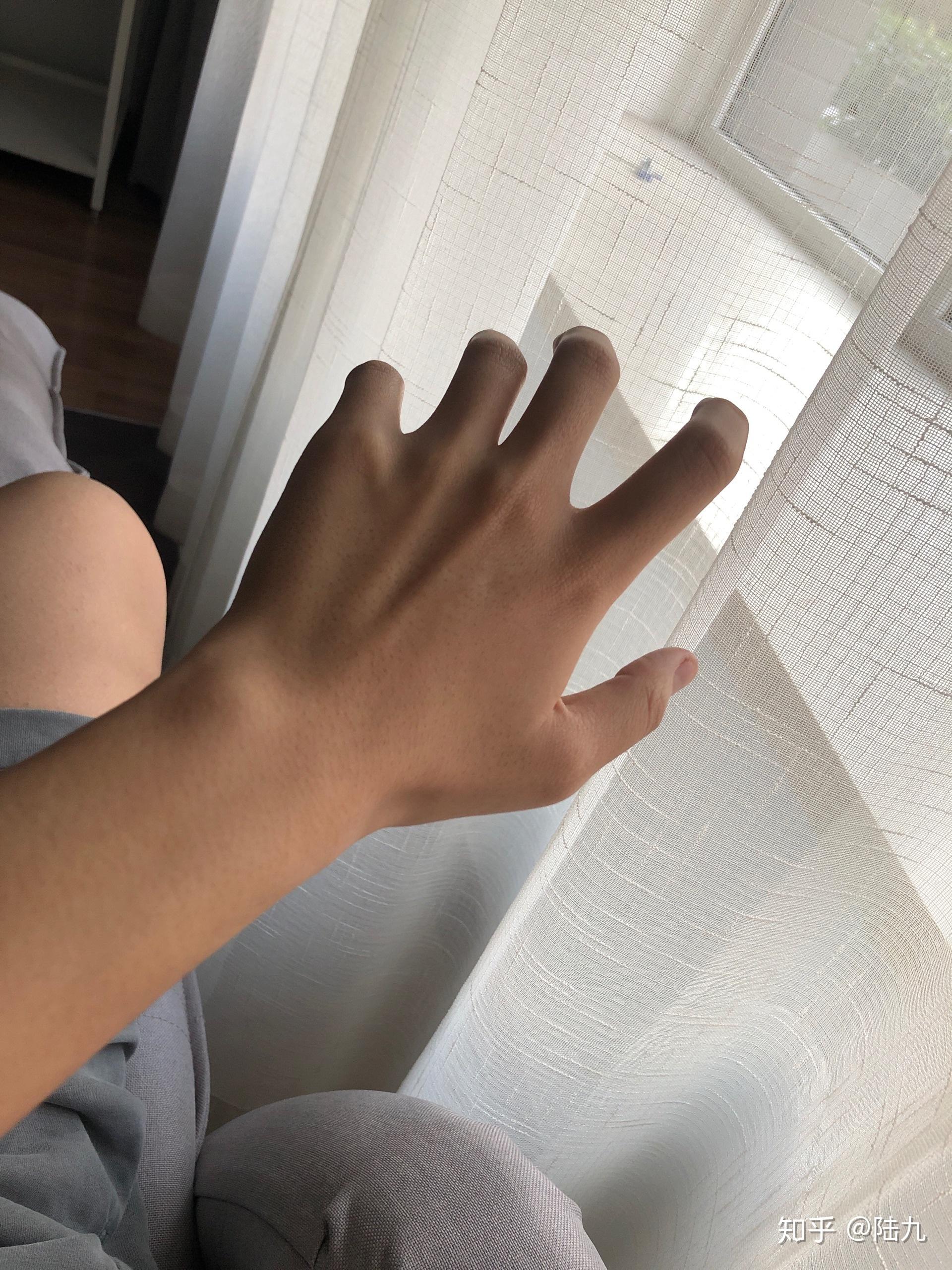 减肥成功的人手瘦了吗