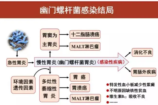 幽门螺杆菌感染的危害