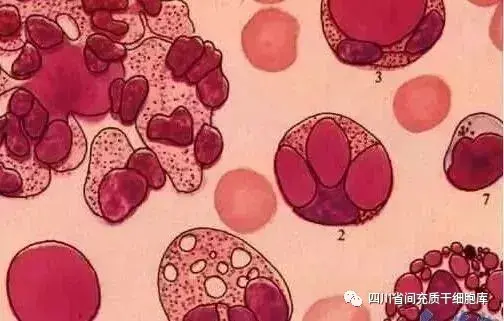 关于子宫内膜干细胞的来源存在不同看法,有学者认为子宫内膜干细胞是