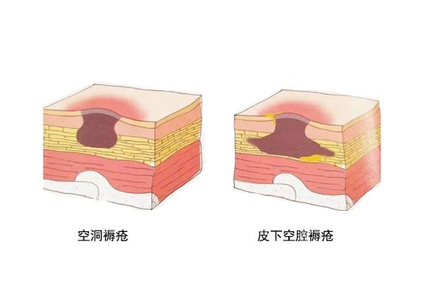 v2-1fa5a5d44e6380085ab6f69fae55703e_r.jpg