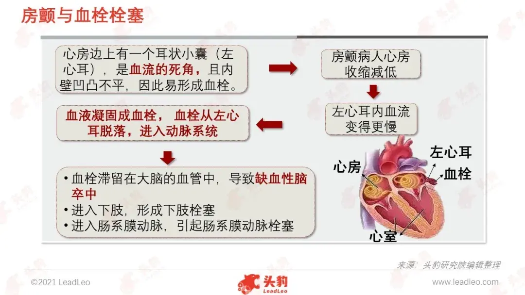 左心耳血栓图片