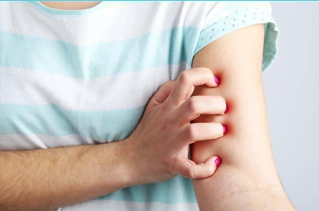 感染hpv有哪些信号医生除了发痒外还要注意这3种表现