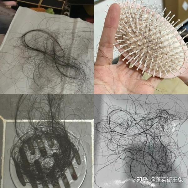 从疯狂脱发到发量暴增,我都用了哪些牛逼国货? - 知乎