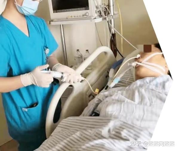 昏迷病人如何鼻饲？3个正确鼻饲技巧干货 - 知乎