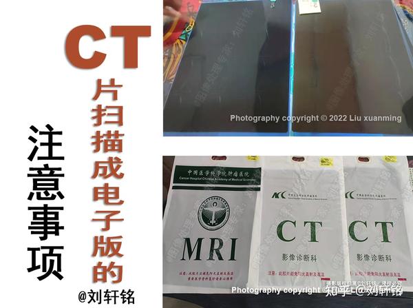 CT胶片扫描成电子版这5点建议你一定要知道 - 知乎