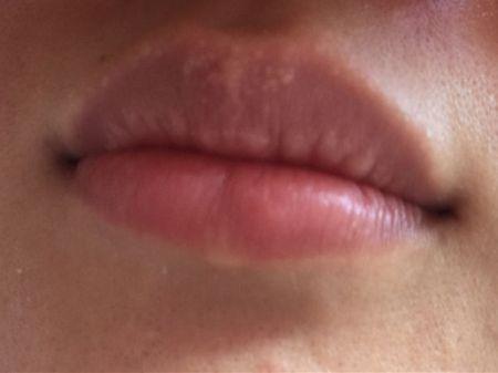 嘴唇上有白点 这是怎么回事 发生在很多人的身上 知乎