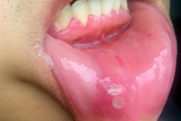 电热毯对孕妇影响大吗(电热毯对孕妇影响大吗有辐射吗