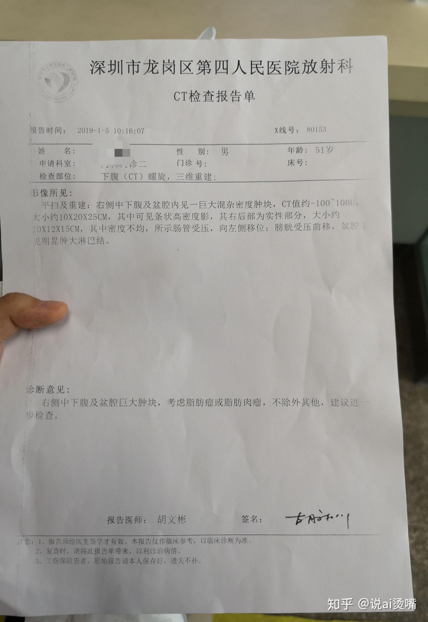 看病经历高分化脂肪肉瘤