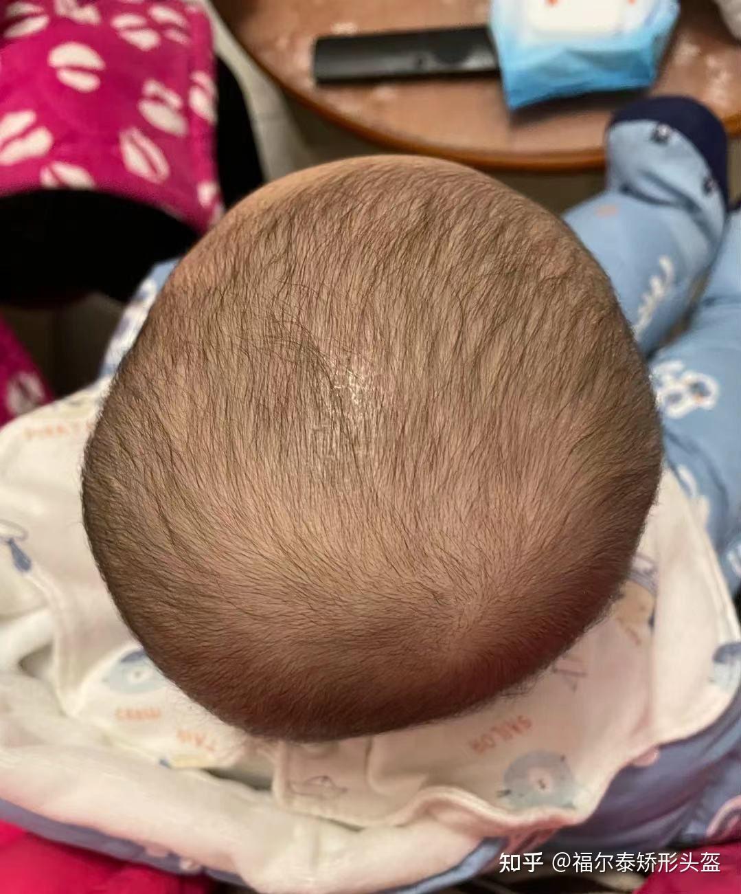 新生儿如何睡头型