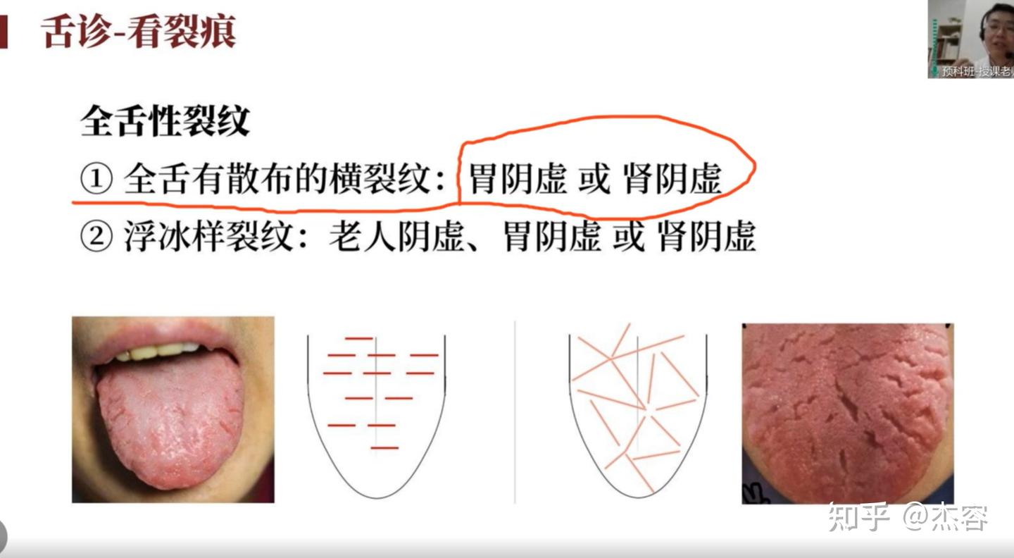 中医学习笔记5:舌诊 - 知乎