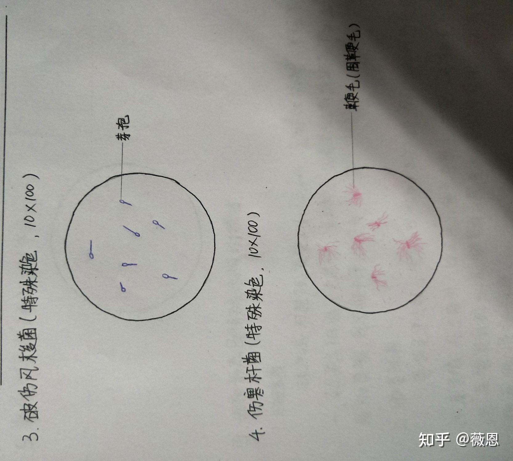 白喉棒状杆菌手绘图图片