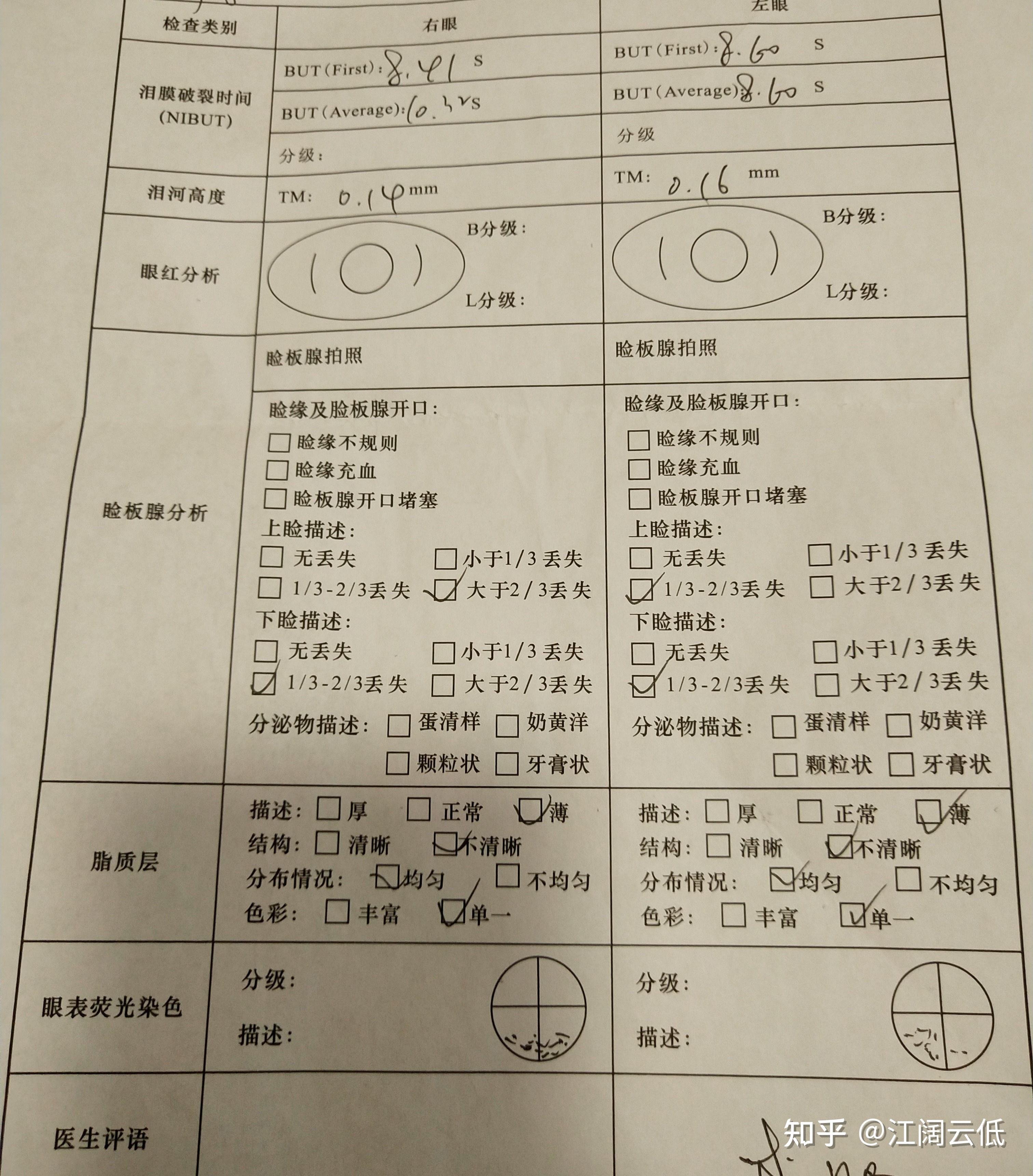 反轉拍訓練並重新配過了眼鏡,在此之前我的眼睛是沒有散光度數的