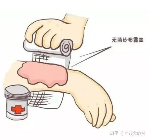 3,创面包扎好还是暴露好?