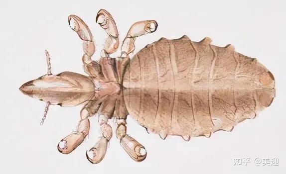 用什么方法可以快速去掉虱子 v2-2133980c956aa42f42a6705640457a6a_r.jpg