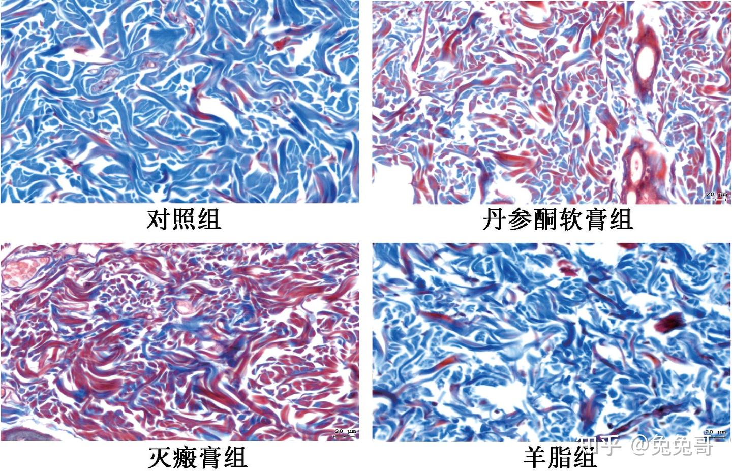灭瘢膏减少瘢痕形成的作用及其机制研究 - 知乎