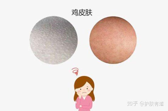裹保鲜膜去鸡皮肤不(保鲜膜敷腿会不会缓解鸡皮)