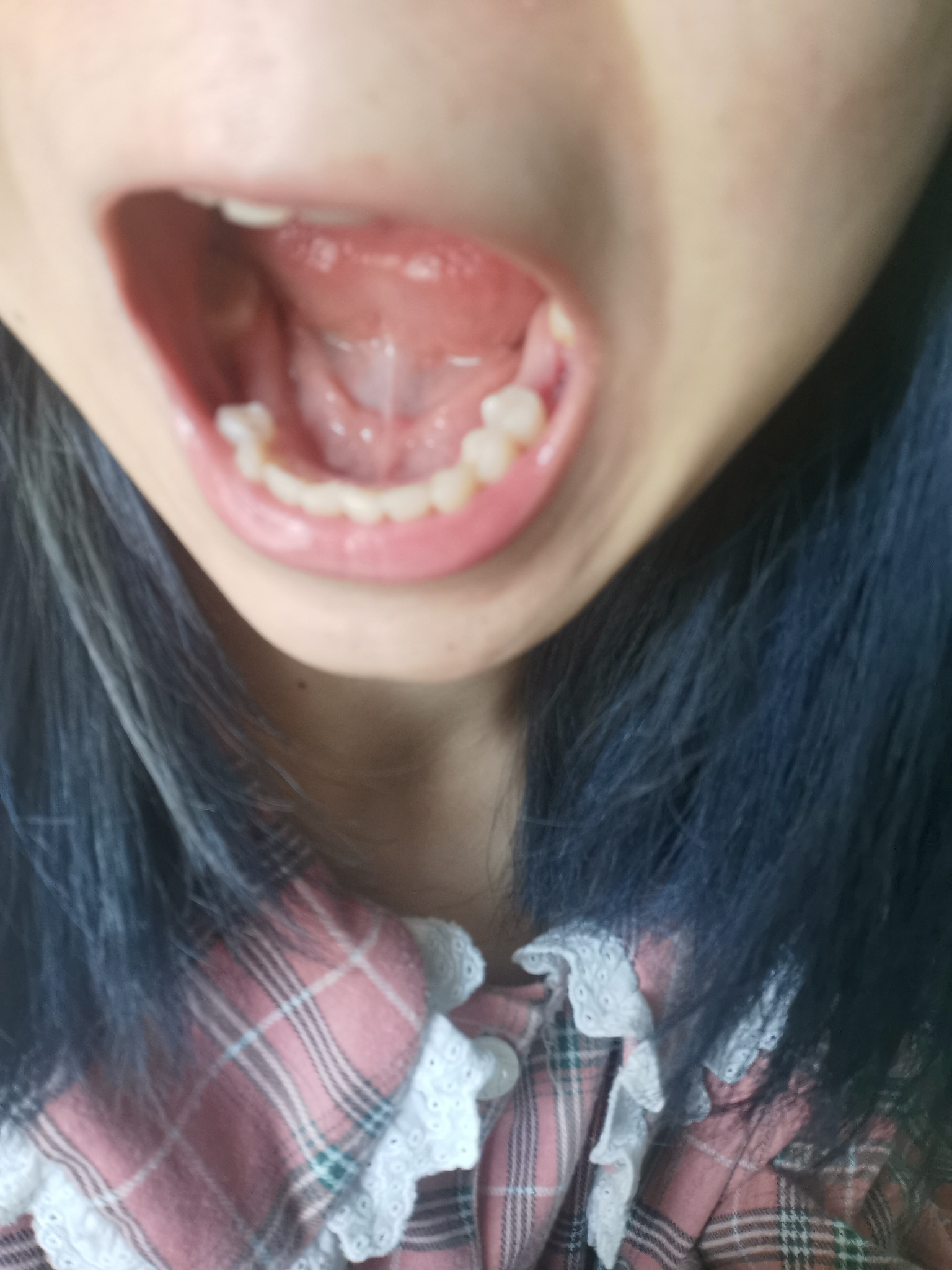 体会过拔七颗牙齿的快乐吗