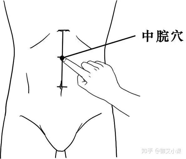 肠梗阻艾灸管用吗以及肠梗阻艾灸穴位和方法分享单桂敏