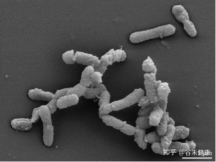 肠道重要菌属——另枝菌属(alistipes),调节炎症情绪等的潜力菌
