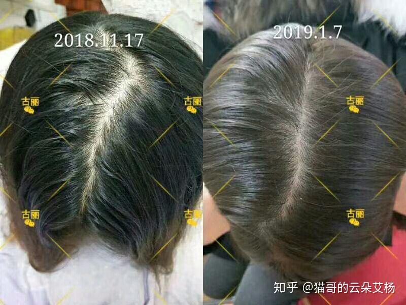 v2-22bc609a16cc7d05411d350dd73a9442_r.jpg