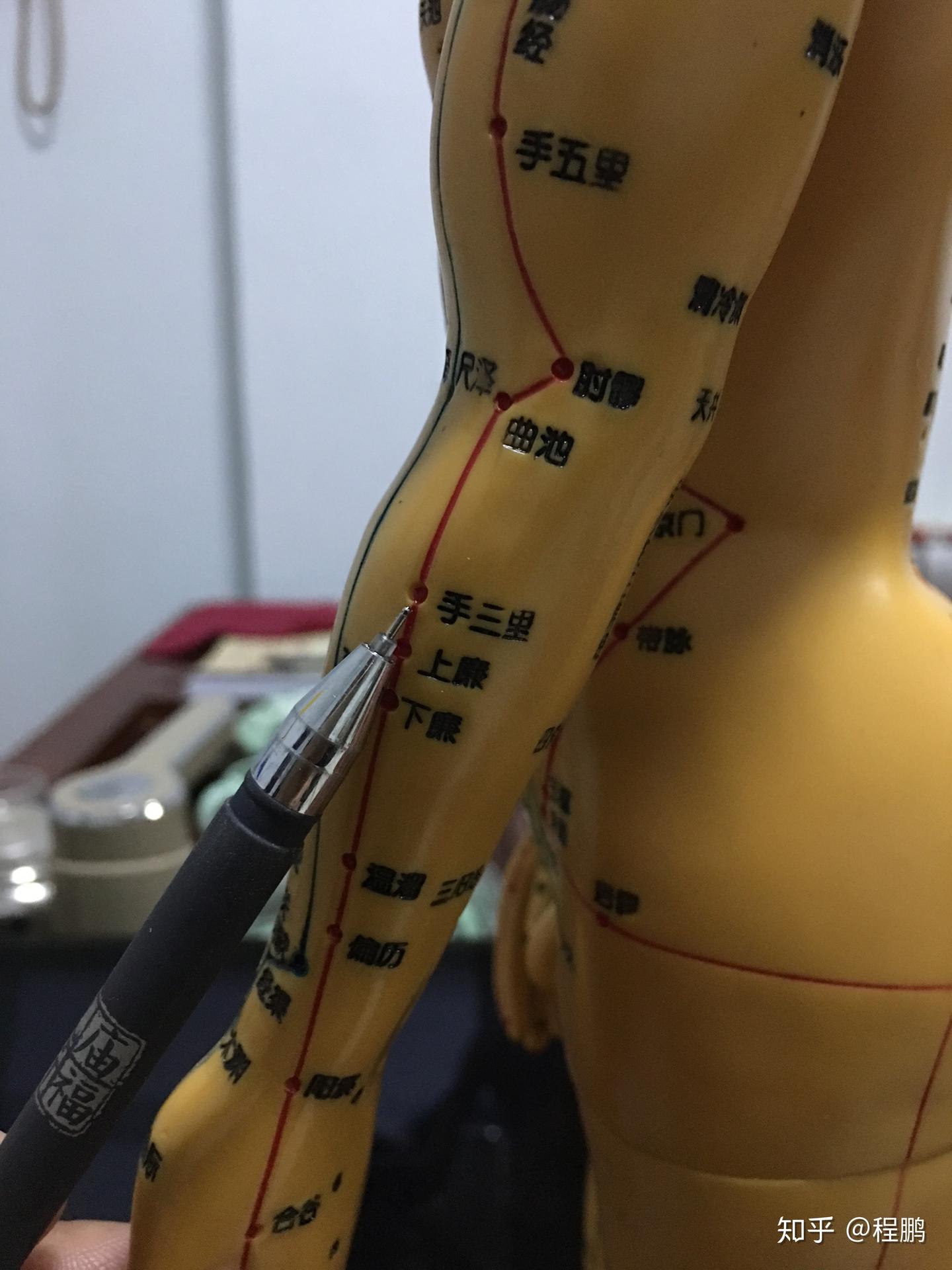 艾灸丨艾灸治疗颈椎病，这几个穴位最有效！ - 知乎