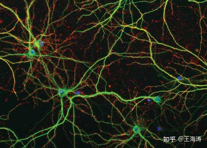 就像从体细胞上长出树枝一样,一个神经元的所有的树枝被称为树突树