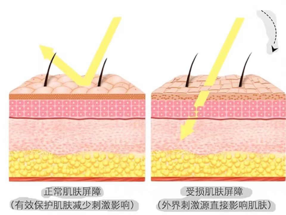 男生毛孔粗大必看男士收缩毛孔用什么最好最有效医学生