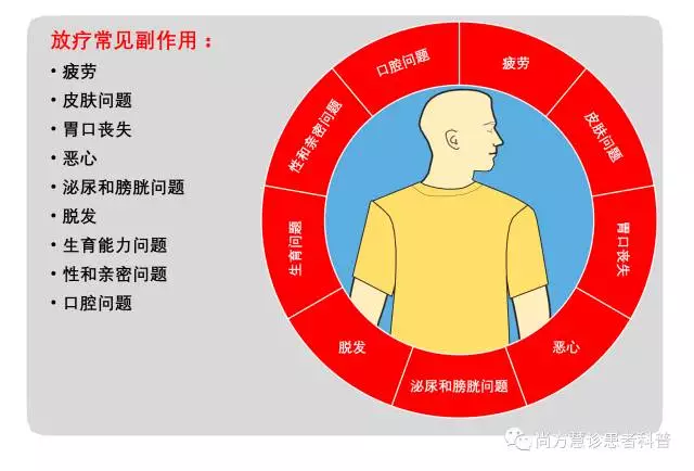 放疗副作用深度科普之一概述篇
