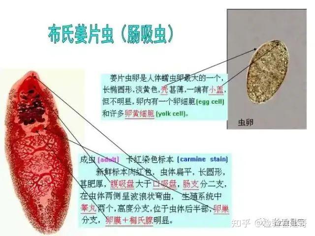 【检验图谱】寄生虫汇总,多图慎入! - 知乎