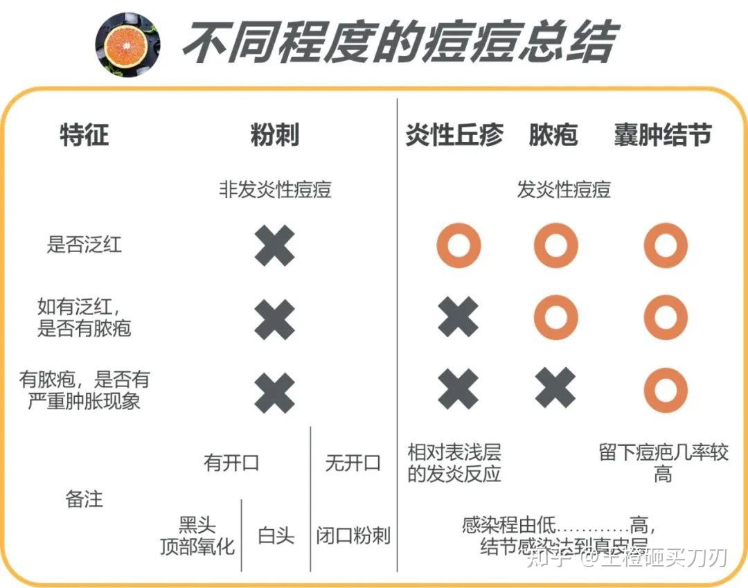 長勢和階段不同,痘痘也表現為以下4種形態:粉刺,炎性丘疹,膿包,結節