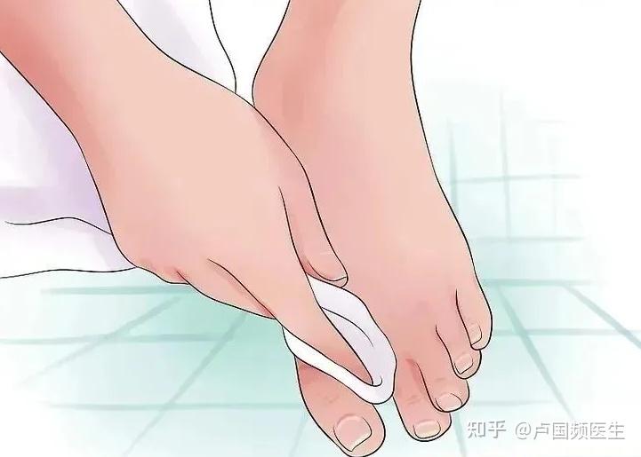 脚痒不一定是“脚气”,也有可能是湿疹,就像脚气也不只长在脚上 - 知乎