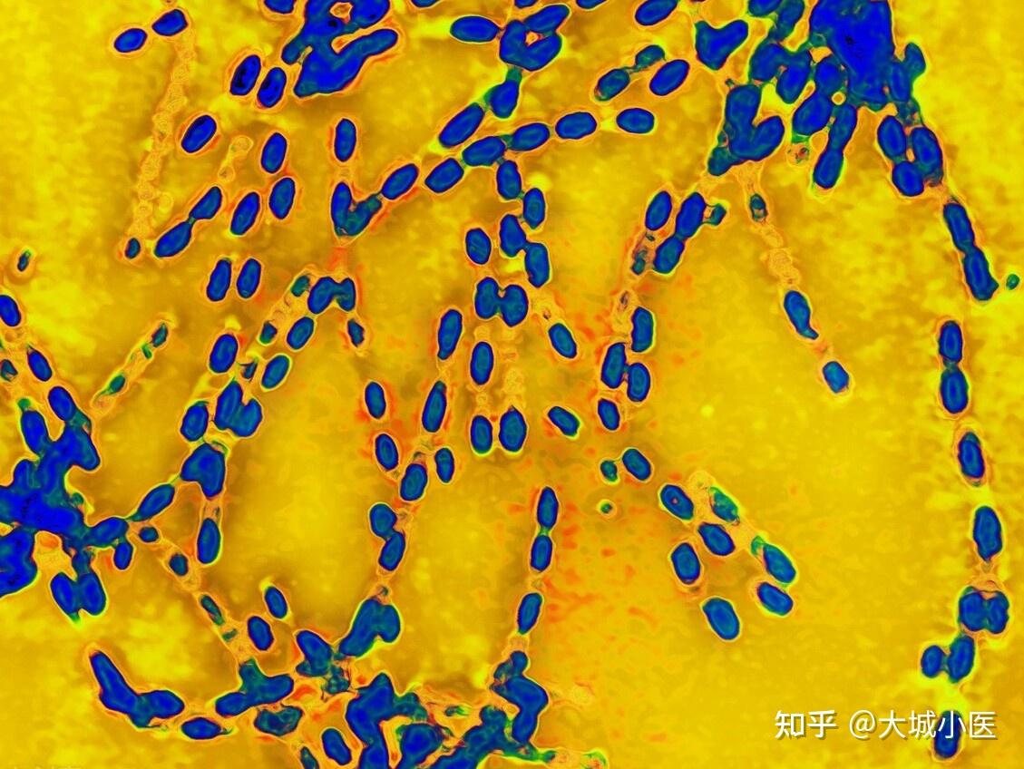 炭疽病是什么感染炭疽杆菌后有什么症状怎么预防炭疽杆菌