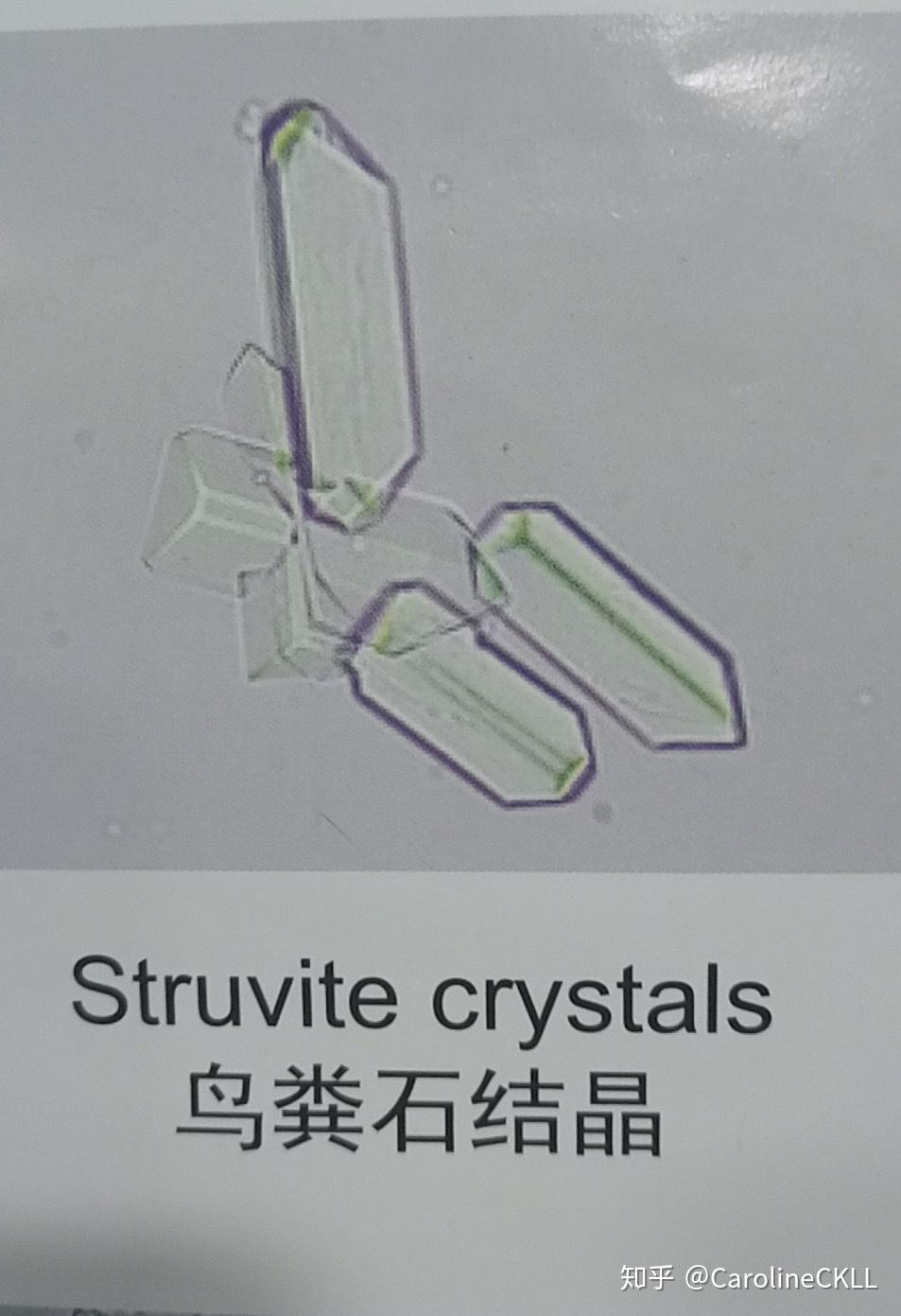 s/o包装上明明白白写着针对鸟粪石结晶……在多方证词的情况下,我信任