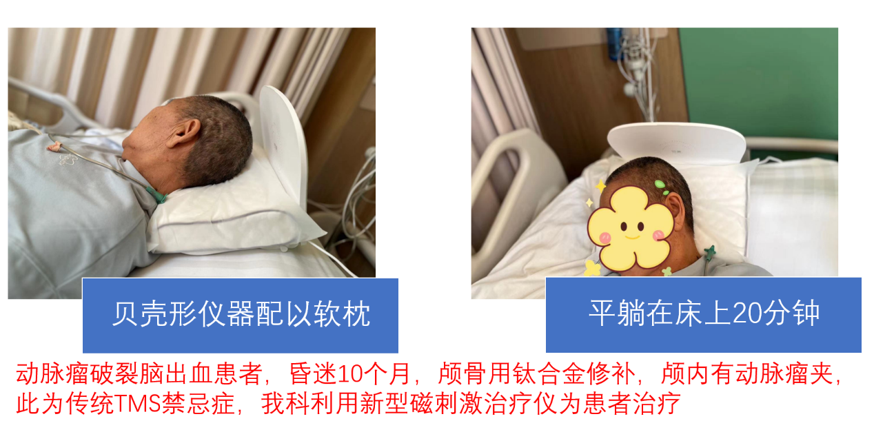 昏迷促醒需要的那些先进设备 - 知乎